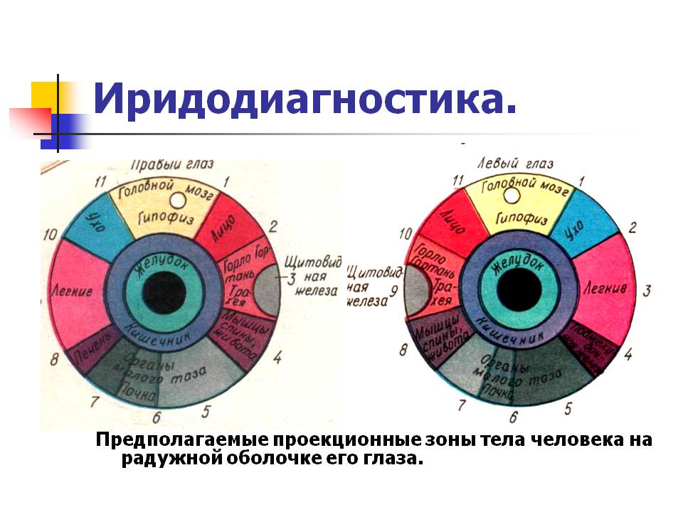 Иридодиагностика