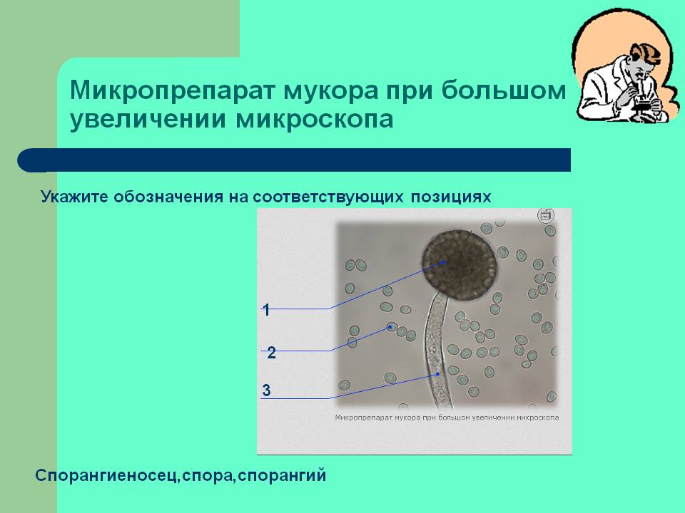 Микропрепарат мукора при большом увеличении микроскопа