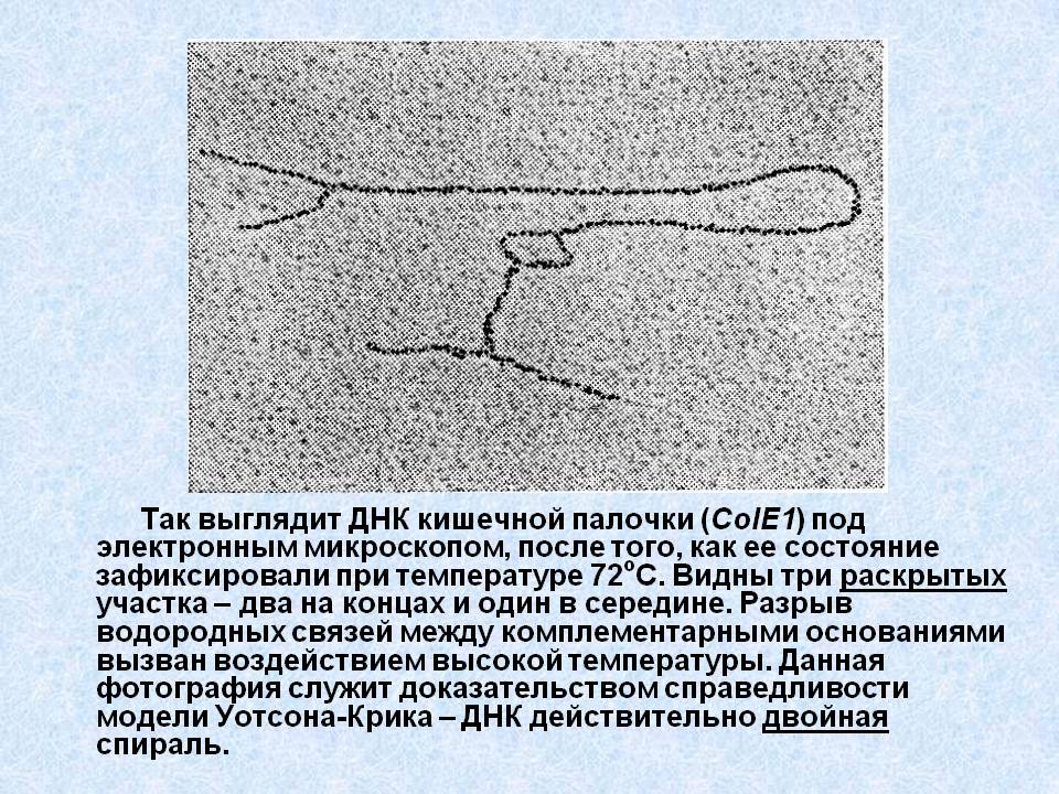 Так выглядит ДНК кишечной палочки (ColE1) под электронным микроскопом,