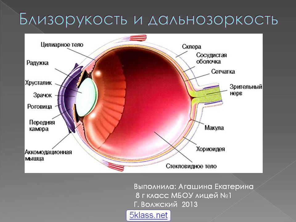 Близорукость и дальнозоркость