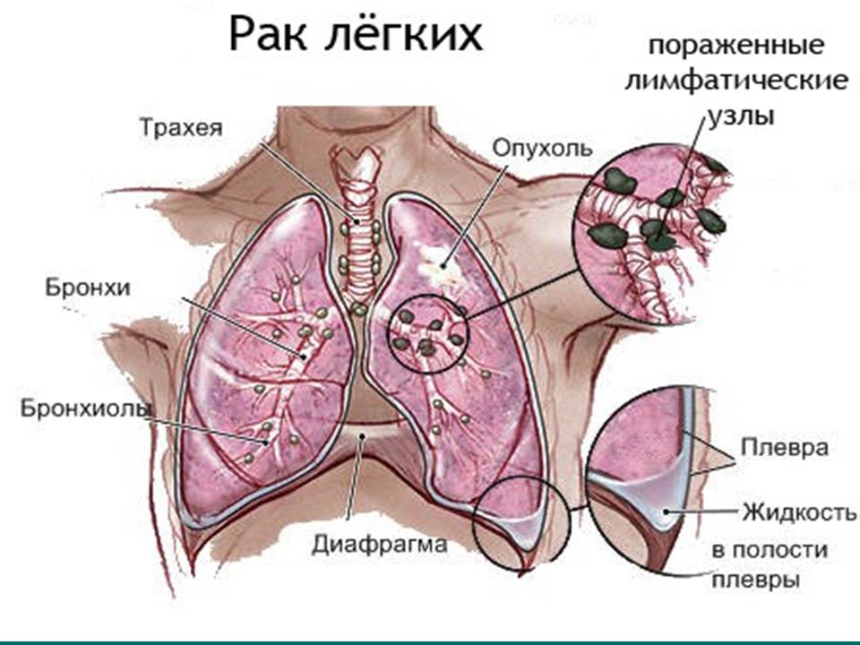 Болезни и травмы органов дыхания