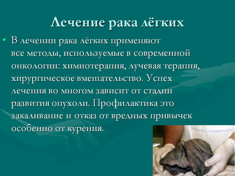 Лечение рака лёгких