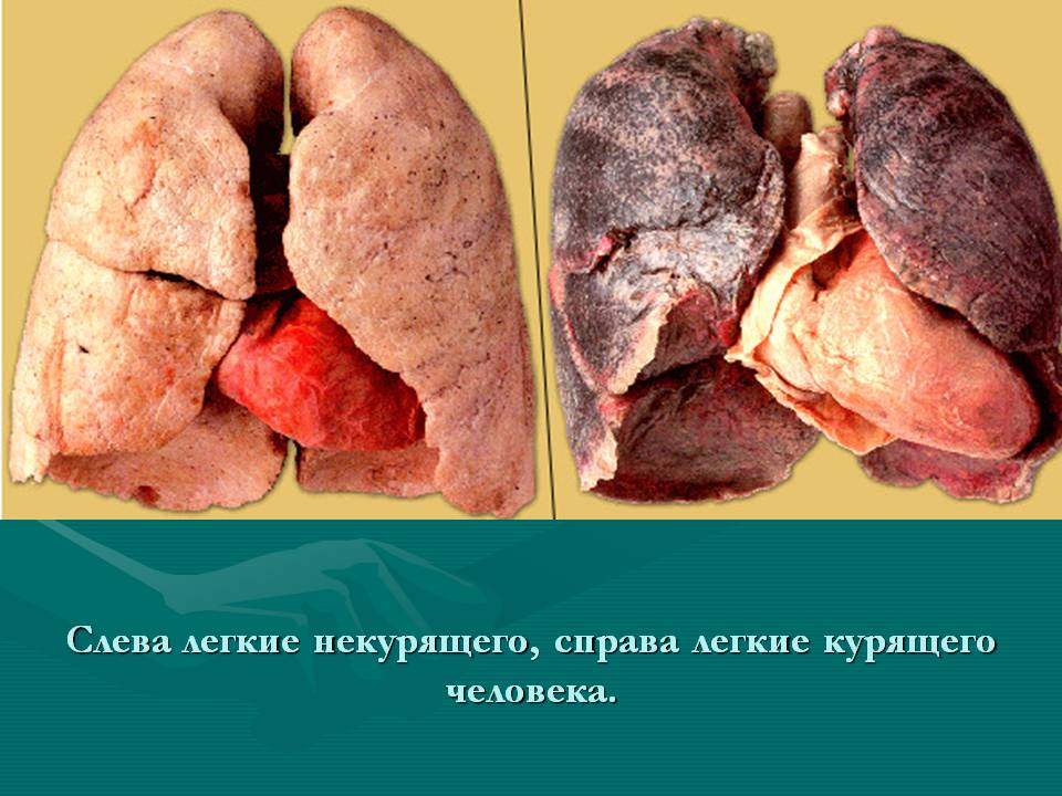 Легкие некурящего