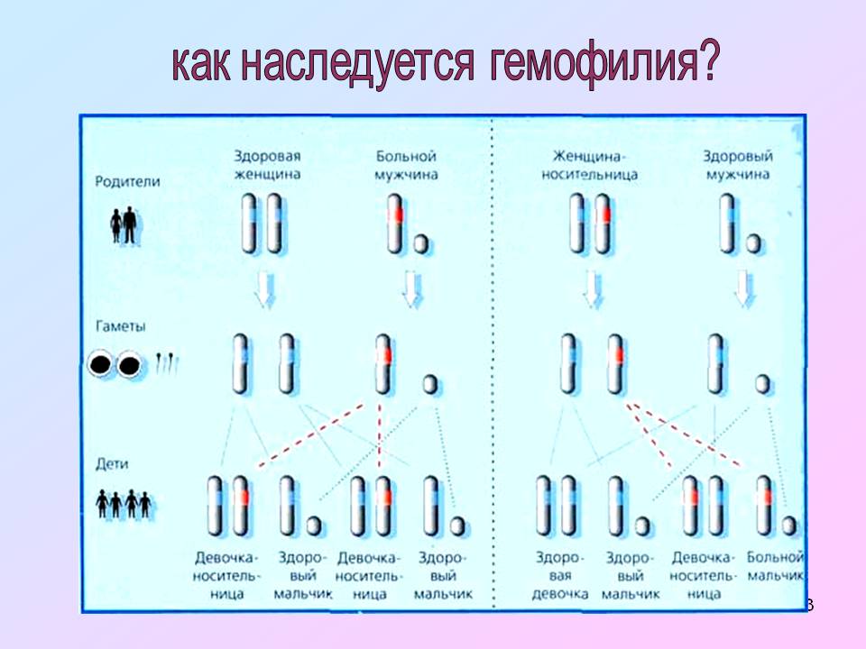 Как наследуется гемофилия