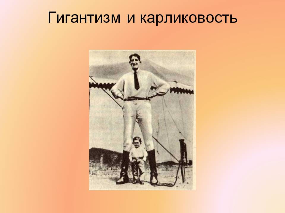 Гигантизм и карликовость