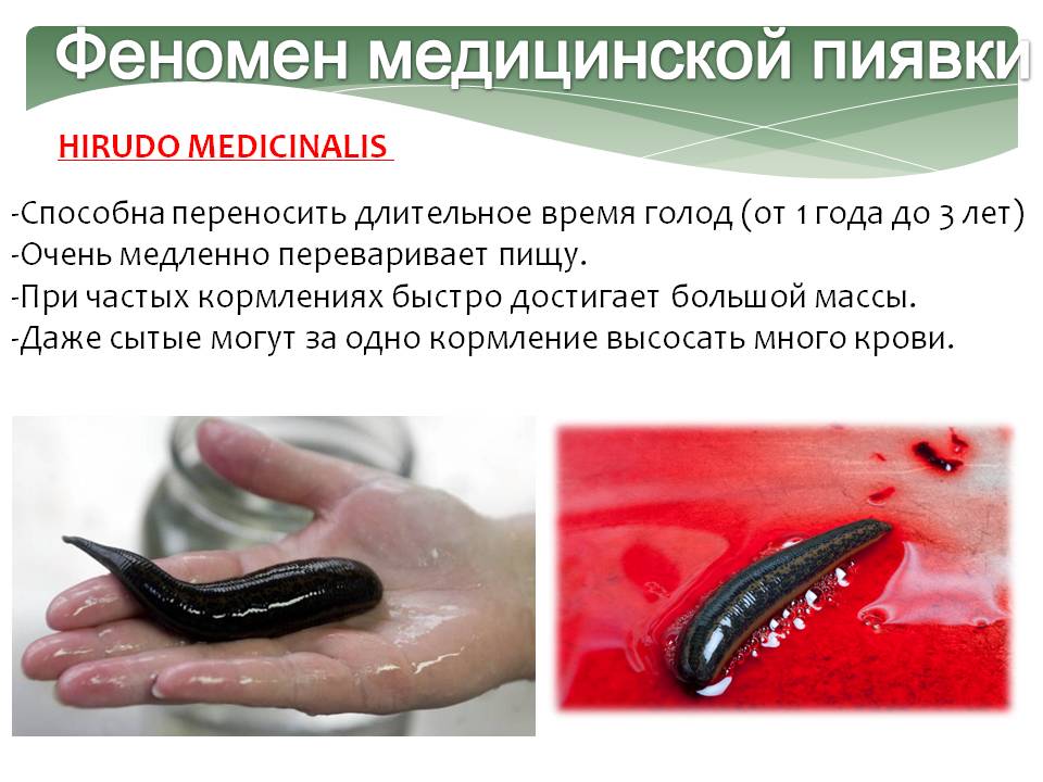 Феномен медицинской пиявки