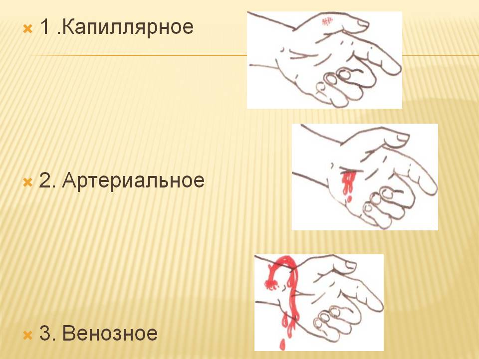 1 .Капиллярное 2. Артериальное 3. Венозное