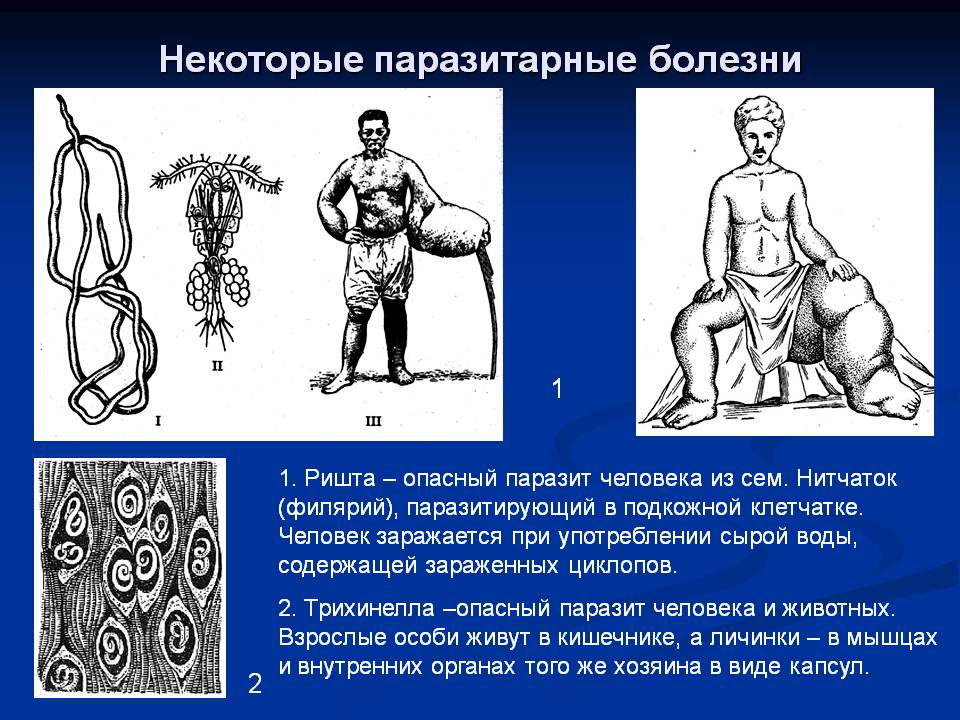 Некоторые паразитарные болезни