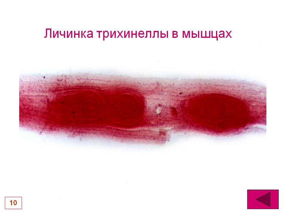 Вошь
