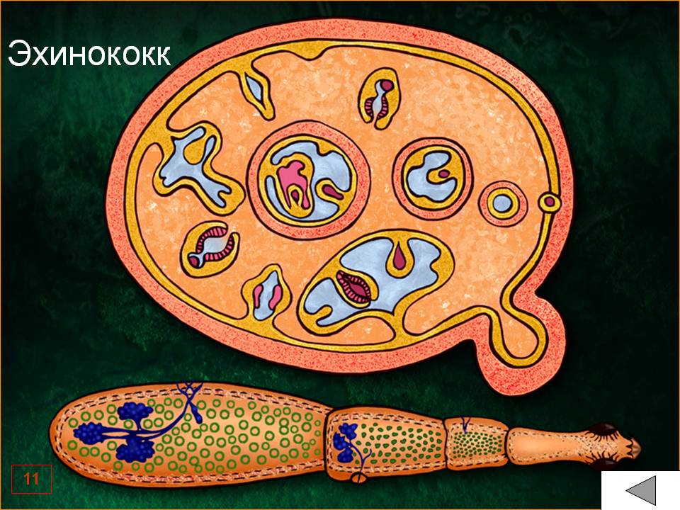 Эхинококк