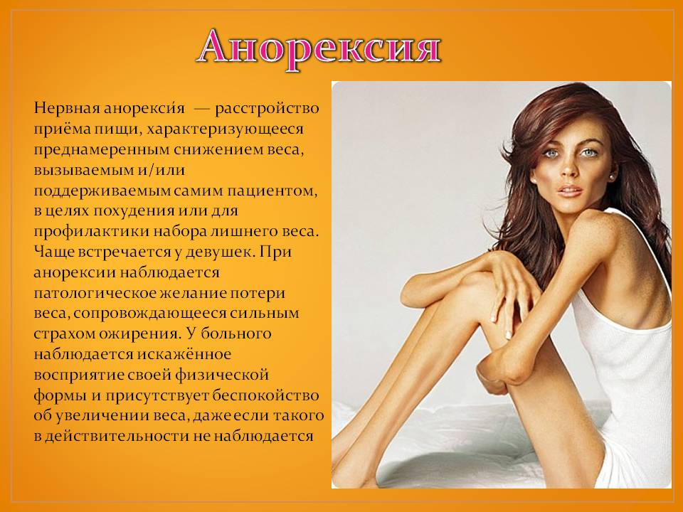 Анорексия