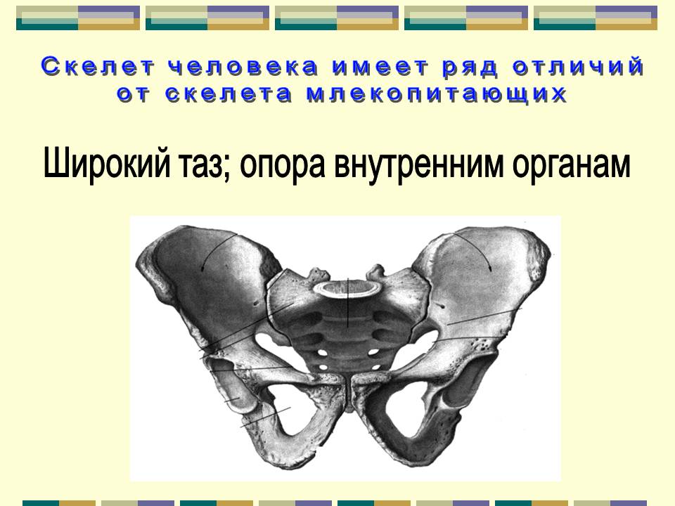 Широкий таз