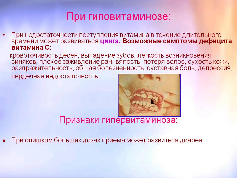 Цинга