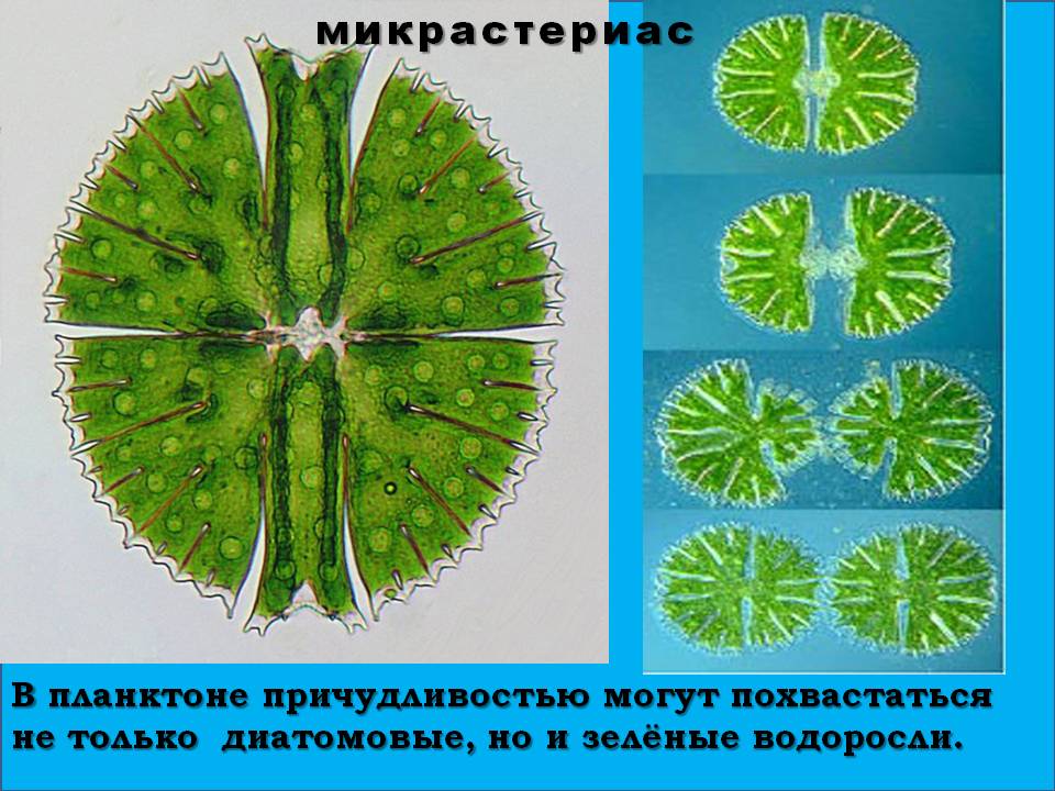 Микрастериас