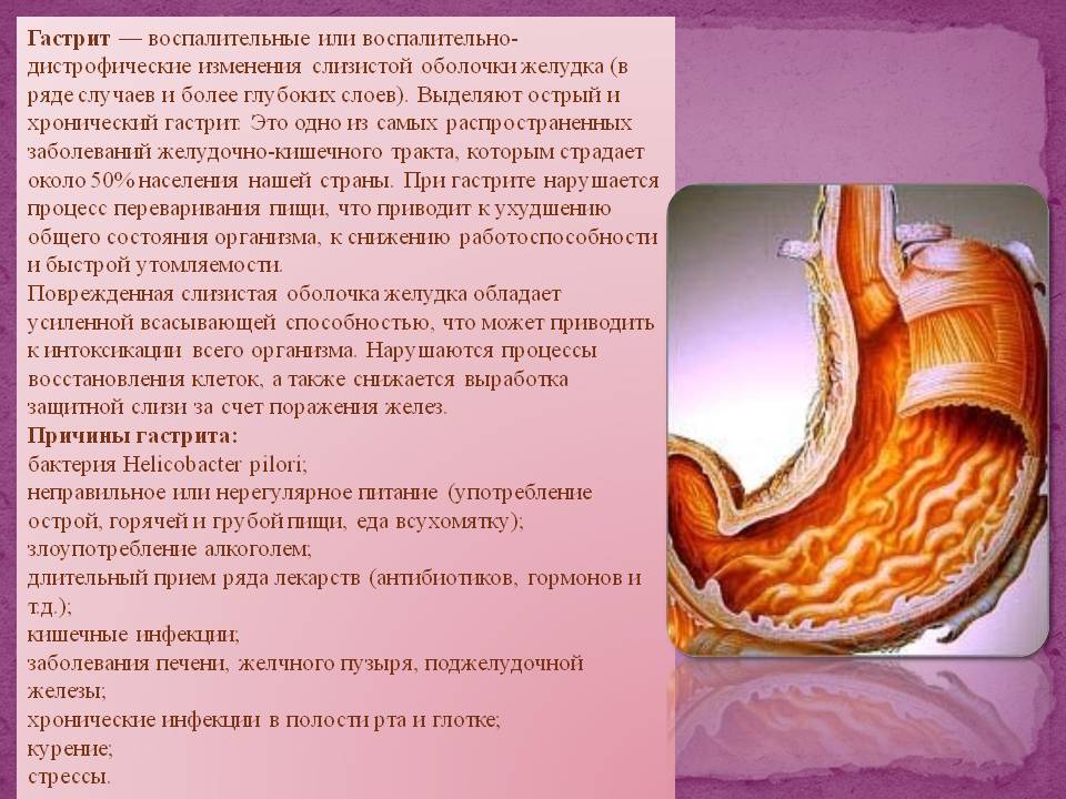 Гастрит — воспалительные или воспалительно-дистрофические изменения