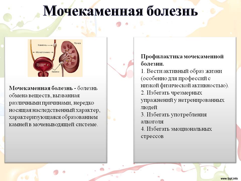 Мочекаменная болезнь