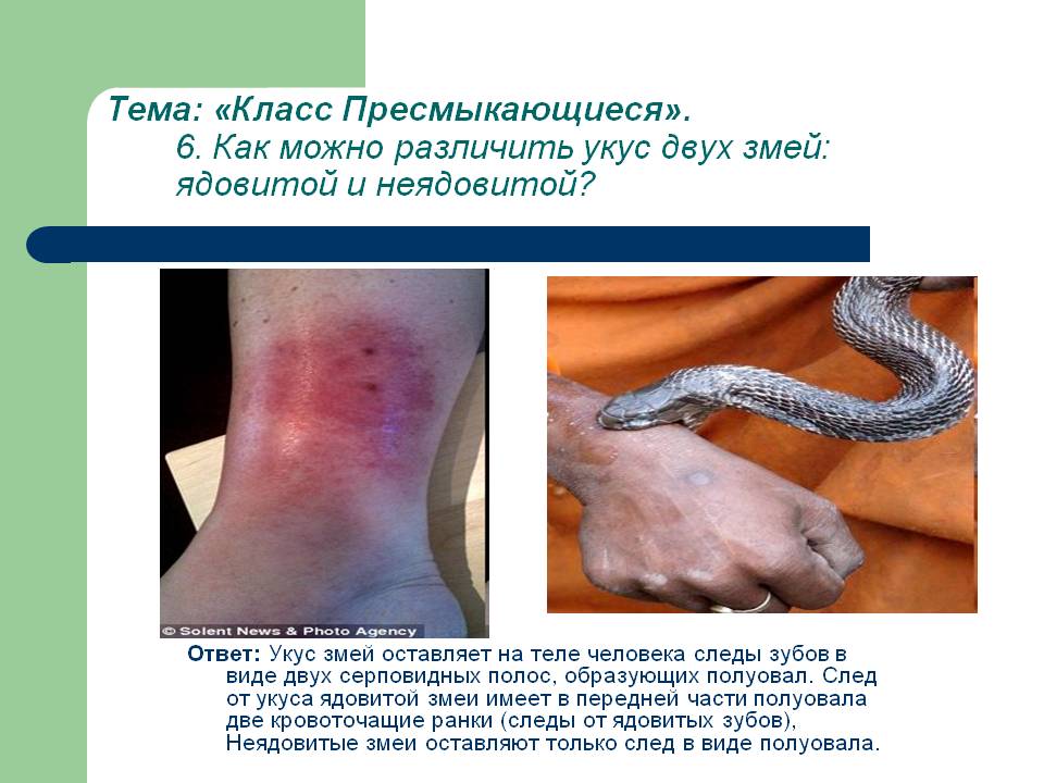 Как можно различить укус двух змей