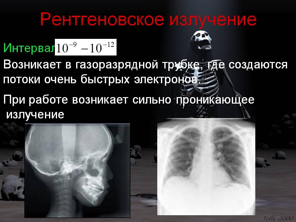 Рентгеновское излучение