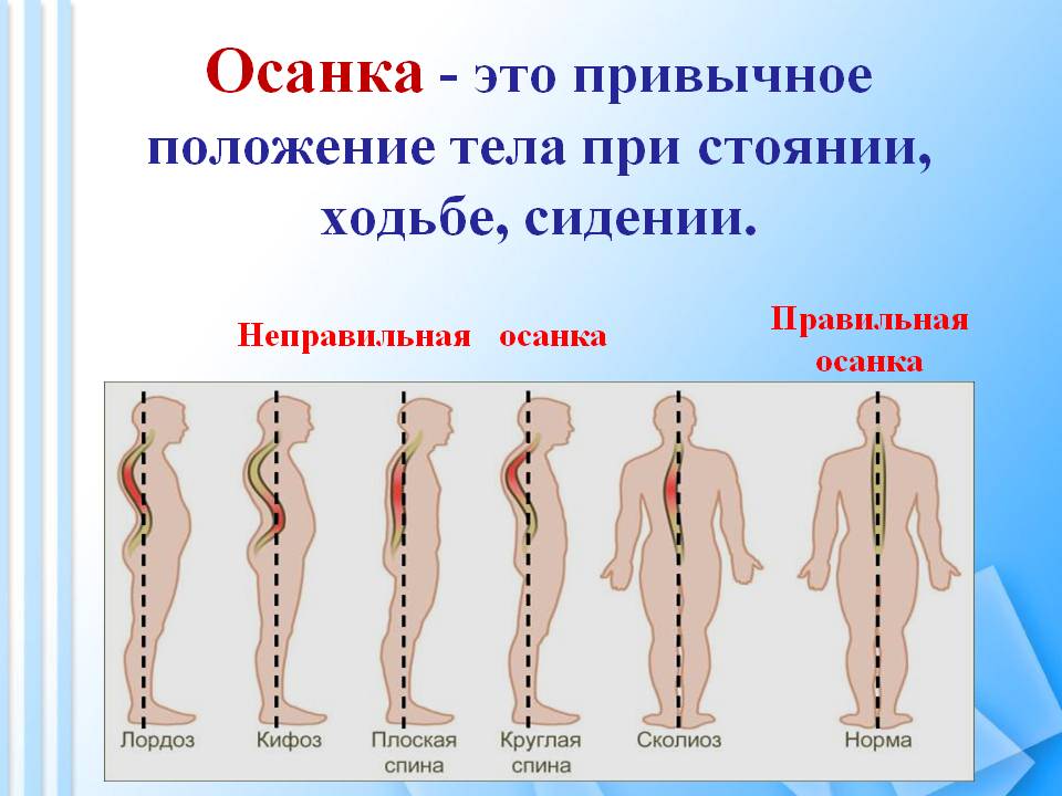 Осанка - это привычное положение тела при стоянии, ходьбе, сидении