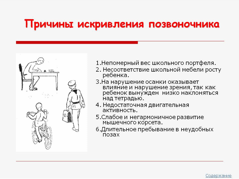 Причины искривления позвоночника