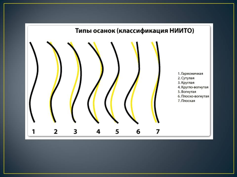 Позвоночник и осанка