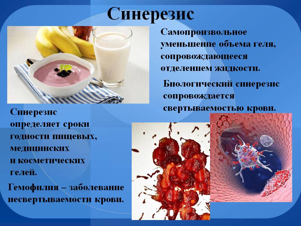 Синерезис