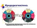 Иридодиагностика