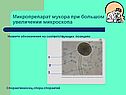 Микропрепарат мукора при большом увеличении микроскопа