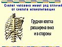 Грудная клетка расширена вниз и в стороны