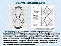 Рентгенограмма ДНК
