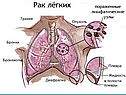 Болезни и травмы органов дыхания