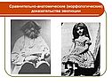 Сравнительно-анатомические (морфологические) доказательства эволюции