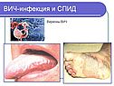 Формы вирусов