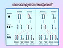 Как наследуется гемофилия