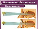 Исправление дефектов зрения