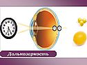 Дальнозоркость