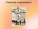 Гигантизм и карликовость