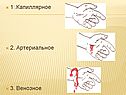 1 .Капиллярное 2. Артериальное 3. Венозное