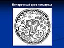 Поперечный срез нематоды