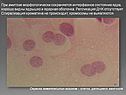 При амитозе морфологически сохраняется интерфазное состояние ядра,