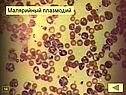 Малярийный плазмодий