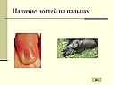 Наличие ногтей на пальцах