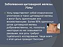 Заболевания щитовидной железы