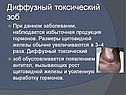 Диффузный токсический зоб