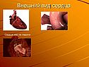 Внешний вид сердца