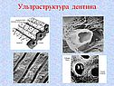 Ультраструктура дентина