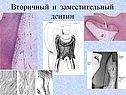 Вторичный и заместительный дентин