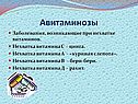 Авитаминозы