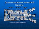 До использования магнитной терапии