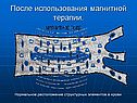 После использования магнитной терапии